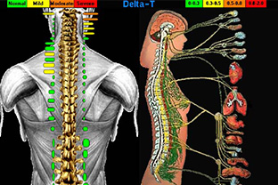 コンピュータサーモグラフィー(C-3000)