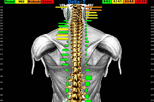 コンピュータサーモグラフィー(C-3000)